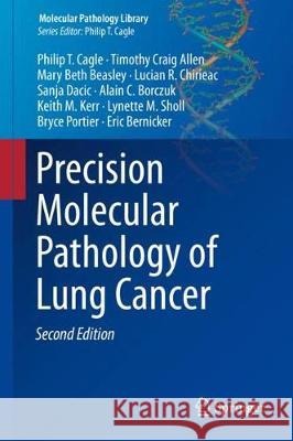 Precision Molecular Pathology of Lung Cancer Philip T. Cagle Timothy Craig Allen Mary Beth Beasley 9783319629407 Springer - książka