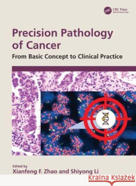 Precision Pathology of Cancer: From Basic Concept to Clinical Practice Xianfeng F Shiyong Li 9781032844862 CRC Press - książka