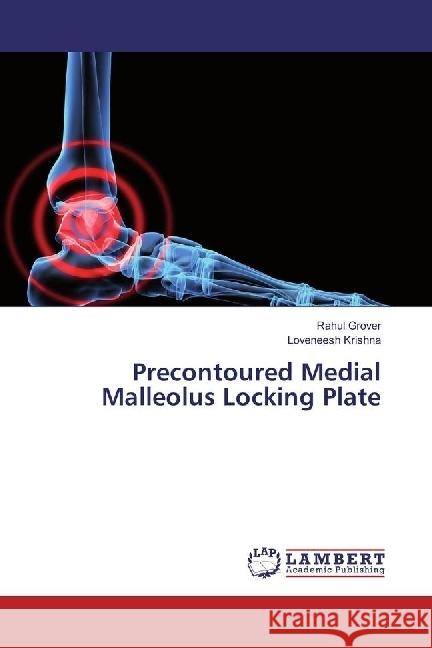 Precontoured Medial Malleolus Locking Plate Grover, Rahul; Krishna, Loveneesh 9783659931406 LAP Lambert Academic Publishing - książka