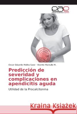 Predicción de severidad y complicaciones en apendicitis aguda Molina Saez, Oscar Eduardo 9786202122269 Editorial Académica Española - książka