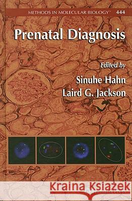 Prenatal Diagnosis Laird G. Jackson 9781588298034 Humana Press - książka