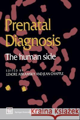 Prenatal Diagnosis: The Human Side Abramsky, Lenore 9780412553608 Springer - książka