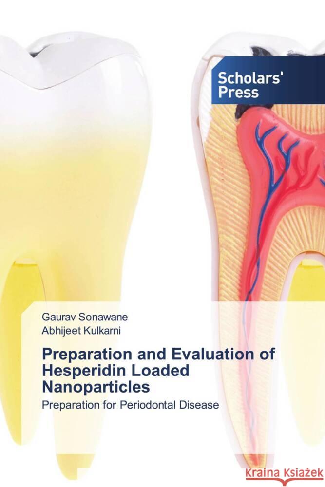 Preparation and Evaluation of Hesperidin Loaded Nanoparticles Sonawane, Gaurav, Kulkarni, Abhijeet 9783330652613 Scholar's Press - książka