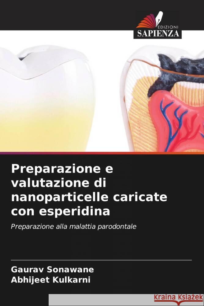 Preparazione e valutazione di nanoparticelle caricate con esperidina Sonawane, Gaurav, Kulkarni, Abhijeet 9786205596616 Edizioni Sapienza - książka