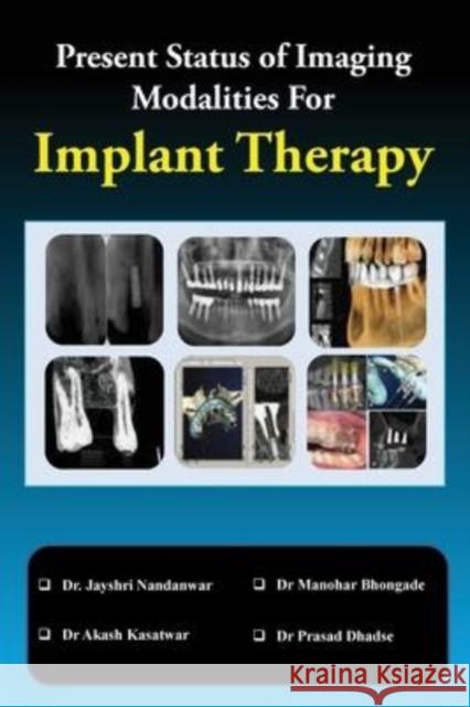 Present Status of Imaging Modalities For Implant Therapy Jayshri Nandanwar Manohar Bhongade 9789354461989 Cyscoprime Publishers - książka