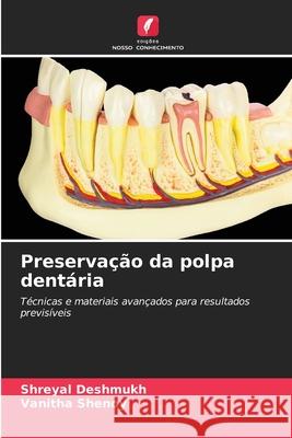 Preservação da polpa dentária Deshmukh, Shreyal, Shenoy, Vanitha 9786206762973 Edições Nosso Conhecimento - książka