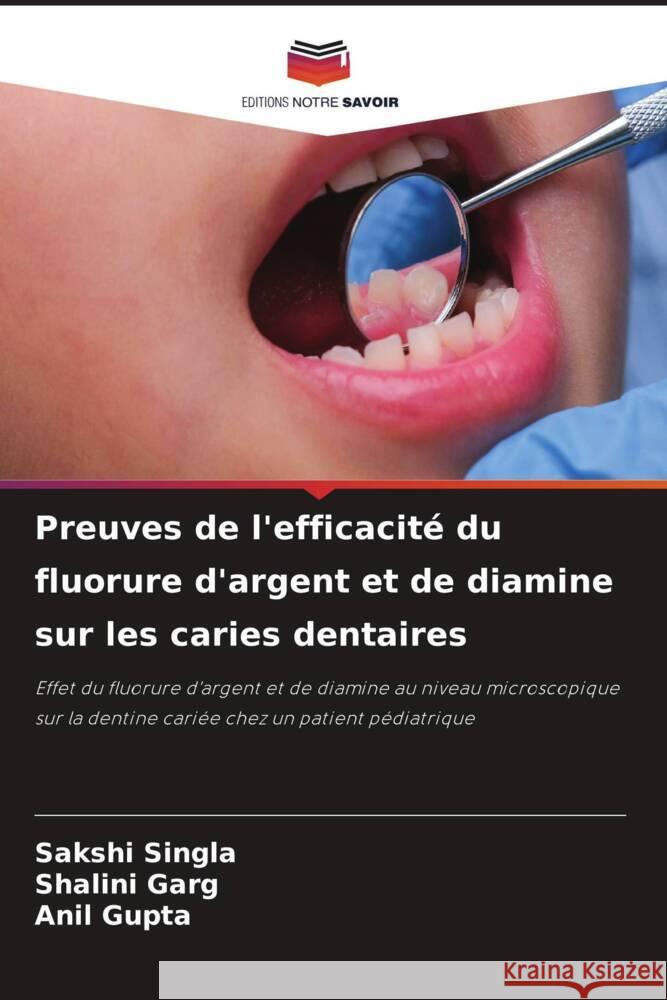 Preuves de l'efficacit? du fluorure d'argent et de diamine sur les caries dentaires Sakshi Singla Shalini Garg Anil Gupta 9786208153731 Editions Notre Savoir - książka