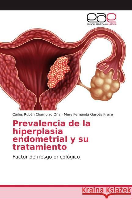 Prevalencia de la hiperplasia endometrial y su tratamiento : Factor de riesgo oncológico Chamorro Oña, Carlos Rubén; Garcés Freire, Mery Fernanda 9786200377081 Editorial Académica Española - książka