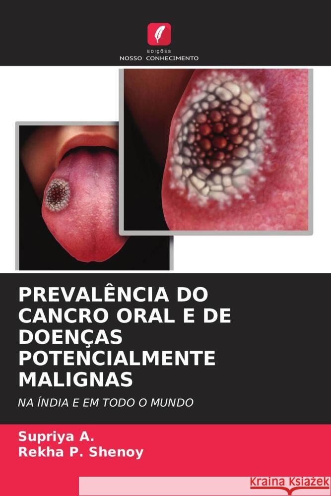 Preval?ncia Do Cancro Oral E de Doen?as Potencialmente Malignas Supriya A Rekha P. Shenoy 9786206615354 Edicoes Nosso Conhecimento - książka