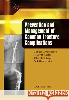 Prevention and Management of Common Fracture Complications Michael Archdeacon Jeff Anglen 9781556429750 Slack - książka