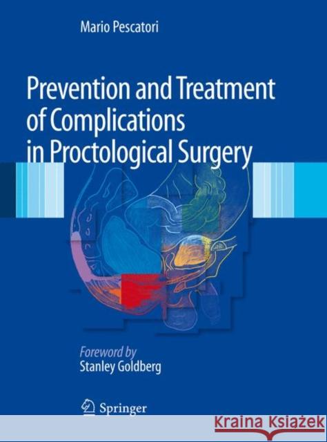 Prevention and Treatment of Complications in Proctological Surgery Mario Pescatori 9788847020764 Springer - książka