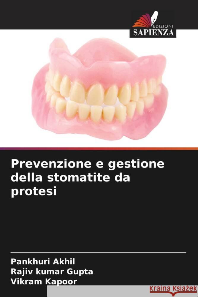 Prevenzione e gestione della stomatite da protesi Akhil, Pankhuri, Gupta, Rajiv kumar, Kapoor, Vikram 9786204493121 Edizioni Sapienza - książka