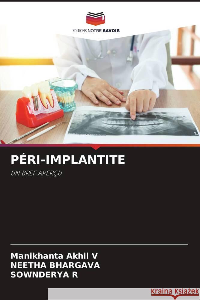 P?ri-Implantite Manikhanta Akhi Neetha Bhargava Sownderya R 9786207382910 Editions Notre Savoir - książka