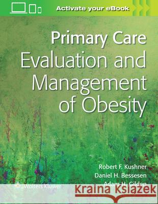 Primary Care: Evaluation and Management of Obesity Robert Kushner 9781975145750 LWW - książka