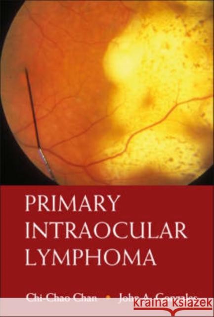 Primary Intraocular Lymphoma Chi-Chao Chan John A. Gonzales 9789812704078 WORLD SCIENTIFIC PUBLISHING CO PTE LTD - książka