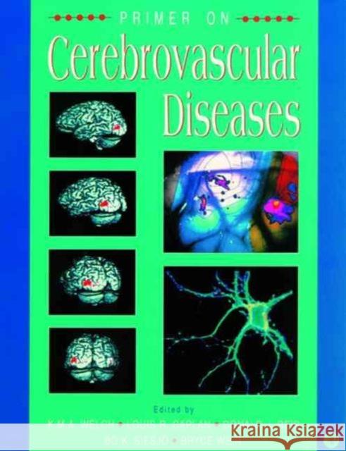 Primer on Cerebrovascular Diseases Welch                                    K. M. Welch Louis R. Caplan 9780127431710 Academic Press - książka