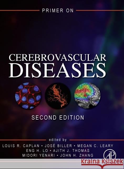 Primer on Cerebrovascular Diseases Louis R. Caplan Jose Biller Megan C. Leary 9780128030585 Academic Press - książka