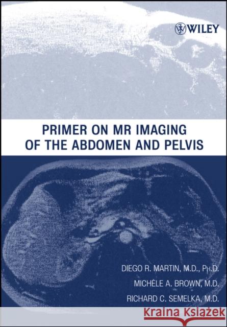 Primer on MR Imaging of the Abdomen and Pelvis Diego R. Martin Richard C. Semelka Michele A. Brown 9780471373407 Wiley-Liss - książka