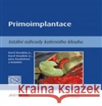 Primoimplantace totální náhrady kolenního kloubu kolektiv 9788088046066 Axonite - książka