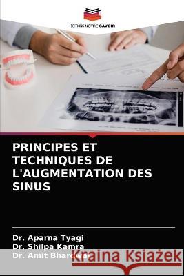 Principes Et Techniques de l'Augmentation Des Sinus Aparna Tyagi Shilpa Kamra Amit Bhardwaj 9786203378467 Editions Notre Savoir - książka