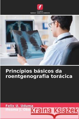 Principios basicos da roentgenografia toracica Felix U Uduma Ifeoma J Okoye  9786206013839 Edicoes Nosso Conhecimento - książka