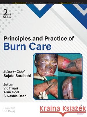 Principles and Practice of Burn Care Sujata Sarabahi, VK Tiwari, Arun Goel 9789356967700 Jaypee Brothers Medical Publishers - książka