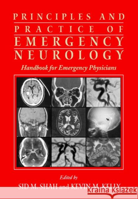 Principles and Practice of Emergency Neurology: Handbook for Emergency Physicians Shah, Sid M. 9780521009805 Cambridge University Press - książka