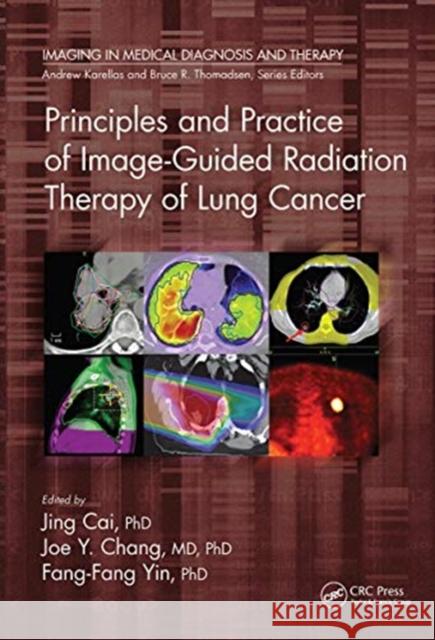 Principles and Practice of Image-Guided Radiation Therapy of Lung Cancer Jing Cai Joe Y. Chang Fang-Fang Yin 9780367781866 CRC Press - książka