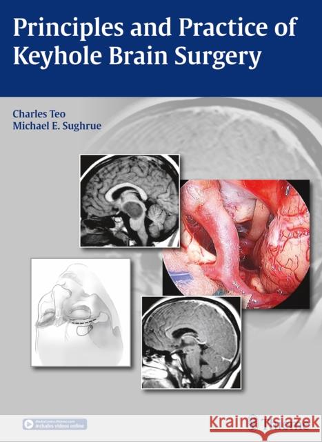 Principles and Practice of Keyhole Brain Surgery Charles Teo Michael E. Sughrue  9783132431911 Thieme Publishing Group - książka