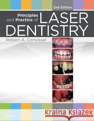 Principles and Practice of Laser Dentistry   9780323297622 Elsevier Science - książka