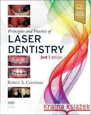Principles and Practice of Laser Dentistry Robert A. Convissar 9780323812832 Elsevier - książka