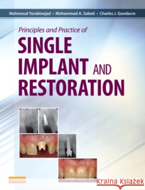 Principles and Practice of Single Implant and Restoration Mahmoud Torabinejad Charles J. Goodacre Mohammed Sabeti 9781455744763 Saunders - książka