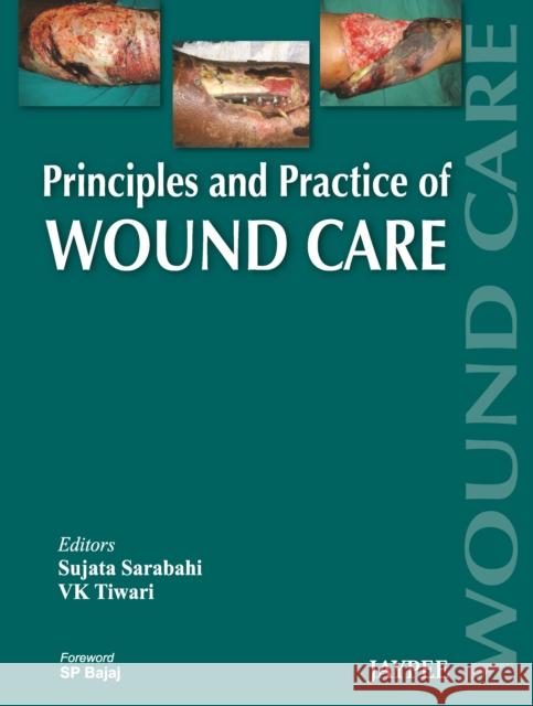 Principles and Practice Of Wound Care  9789350258644 Jaypee Brothers Medical Publishers - książka