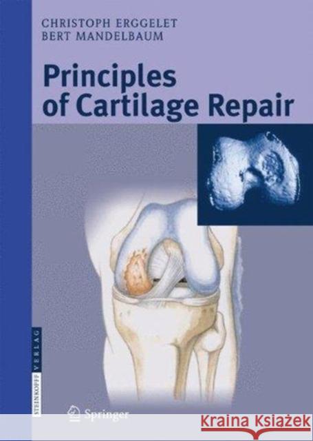 Principles of Cartilage Repair Christoph Erggelet Eike H. Mrosek Bert R. Mandelbaum 9783662526842 Steinkopff - książka