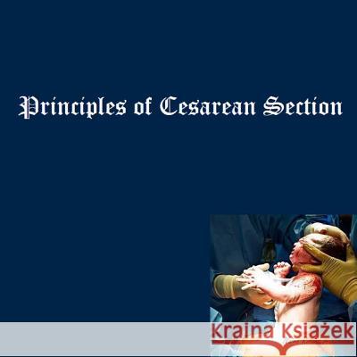 Principles of Cesarean Section Dr Naira R. Matevosyan 9781481858984 Createspace - książka