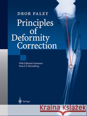 Principles of Deformity Correction Herzenberg, J. E. 9783642639531 Springer - książka