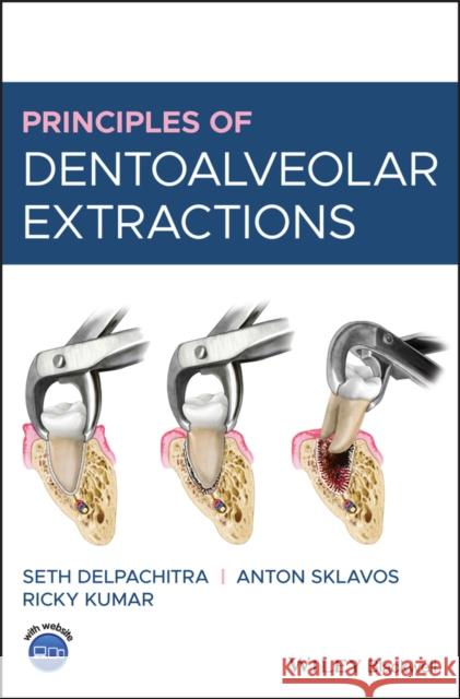 Principles of Dentoalveolar Extractions Seth Delpachitra Anton Sklavos Ricky Kumar 9781119596400 Wiley-Blackwell - książka
