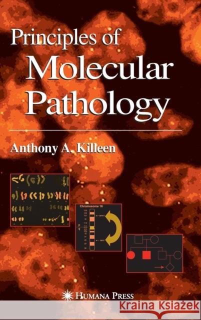 Principles of Molecular Pathology Anthony A. Killeen 9781588290854 Humana Press - książka