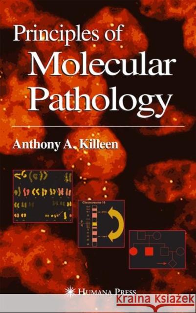 Principles of Molecular Pathology Anthony Killeen 9781617373480 Springer - książka