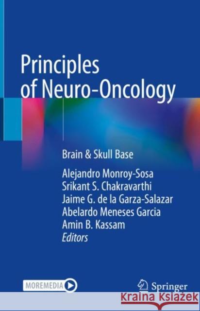 Principles of Neuro-Oncology: Brain & Skull Base Monroy-Sosa, Alejandro 9783030548780 Springer - książka