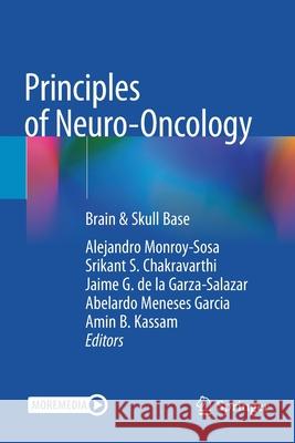 Principles of Neuro-Oncology: Brain & Skull Base Monroy-Sosa, Alejandro 9783030548810 Springer International Publishing - książka