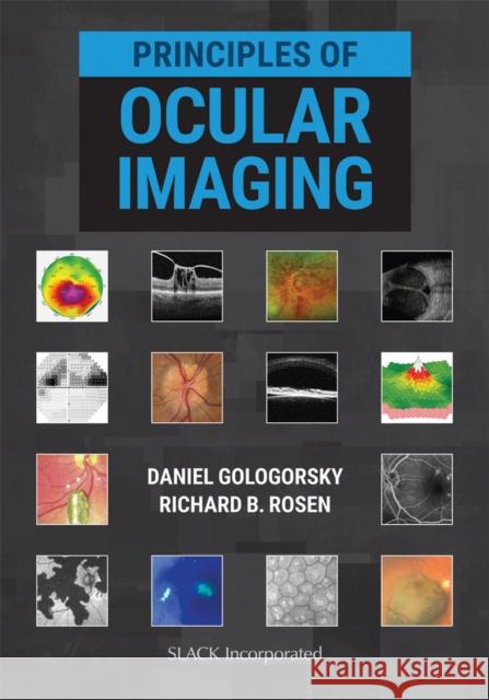 Principles of Ocular Imaging Daniel Gologorsky Richard B. Rosen 9781630915995 Slack - książka