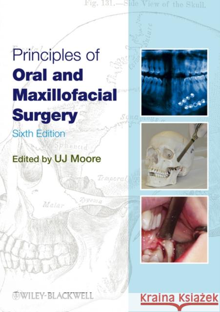 Principles of Oral and Maxillo Moore, U. J. 9781405199988  - książka