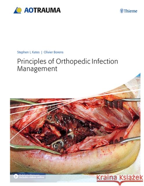 Principles of Orthopedic Infection Management Stephen Kates Olivier Borens 9783132410756 Ao Publishing, Davos - książka