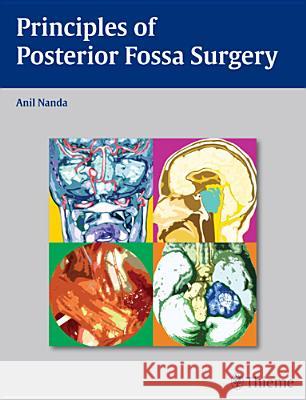 Principles of Posterior Fossa Surgery : Surgical Management Anil Nanda 9781588906632 Thieme, Stuttgart - książka