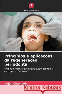 Princípios e aplicações da regeneração periodontal Chambole, Anjali 9786202472029 Edições Nosso Conhecimento - książka