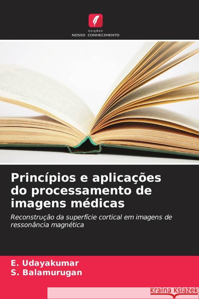 Princ?pios e aplica??es do processamento de imagens m?dicas E. Udayakumar S. Balamurugan 9786207956029 Edicoes Nosso Conhecimento - książka