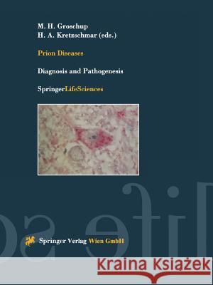 Prion Diseases: Diagnosis and Pathogenesis Groschup, Martin H. 9783211835296 Springer - książka