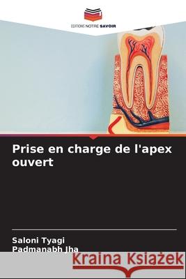 Prise en charge de l'apex ouvert Saloni Tyagi Padmanabh Jha 9786207673339 Editions Notre Savoir - książka