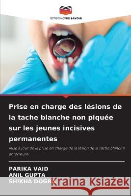 Prise en charge des lesions de la tache blanche non piquee sur les jeunes incisives permanentes Parika Vaid Anil Gupta Shikha Dogra 9786205909355 Editions Notre Savoir - książka